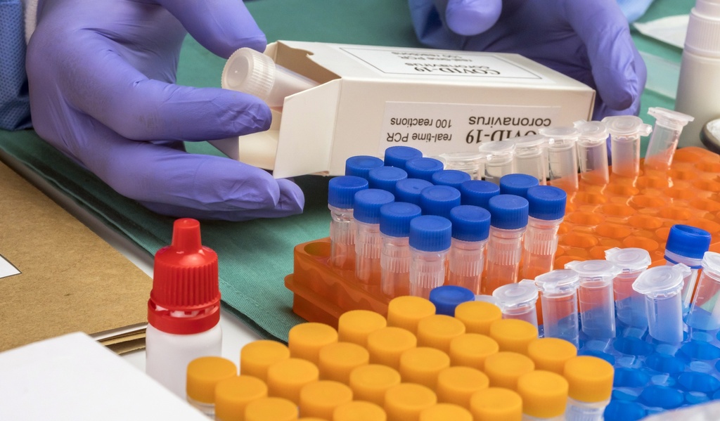 Incyte FL Human cDNA Clone